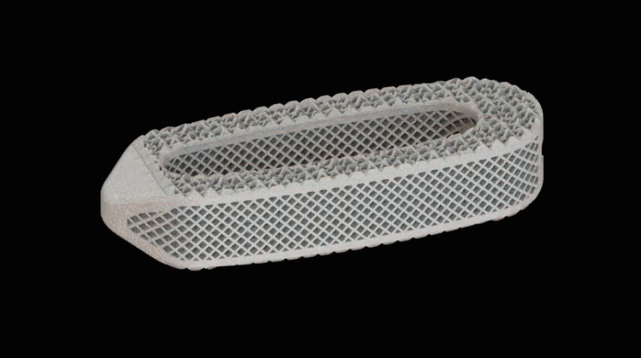 osseus-aries-joseph-spine